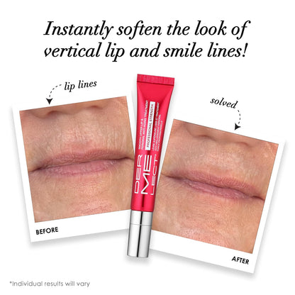 Traitement Anti-Âge Péri-oral - Force Professionnelle